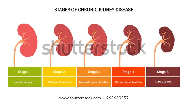 Kidney disease vector illustration. Stages of\
development of renal failure in the human body. Medical anatomical\
poster. Problem in urinary system and normal kidney. Internal\
organs exam concept.