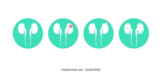 Juego de iconos de riñón. Ilustración vectorial de los riñones. Iconos de la urología. Colección de órganos humanos. Concepto médico.