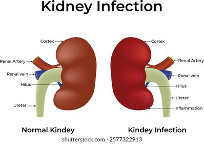 Kidney Infection Normal vs Infected Kidney Design Vector Illustration