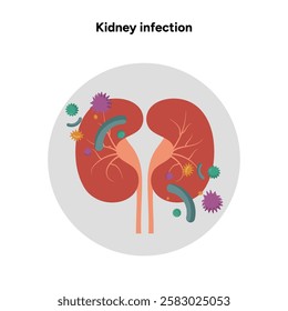 Kidney infection urology urinary problem. Medical diagram 