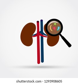 Kidney infection vector illustration.
