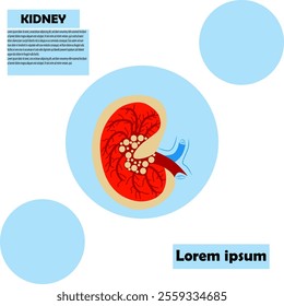 KIDNEY INFO GRAPHICS,VECTOR ILLUSTRATION,WORLD KIDNEY DAY