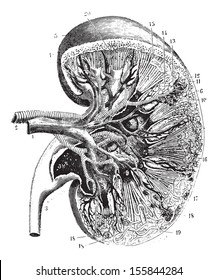 Kidney section, vintage engraved illustration. Usual Medicine Dictionary by Dr Labarthe - 1885.
