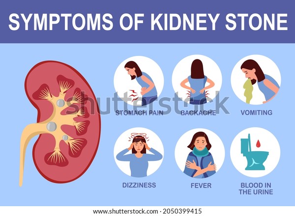 Kidney stone symptom infographic in flat\
design vector\
illustration.