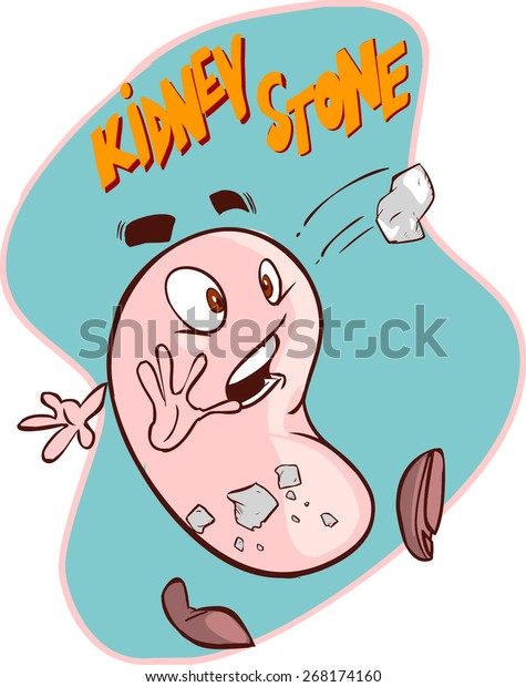 Kidney Stones Stock Vector (Royalty Free) 268174160