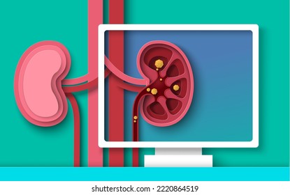 Kidney stones disease examination and diagnosis paper cut 3d vector. Human anatomy of sick internal organ cross section design. Urology, nephrology surgery concept. Health care and medicine