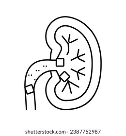 Nierensteine Linie Symbol Vektorgrafik. Nierensteine Schild. isoliertes Kontursymbol