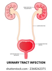 Die Anatomie des Harnsystems, die aus Nierenharnstoff und Harnblase in der Medizin besteht