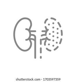 Kidneys amputation line icon. Nephrectomy, one kidney symbol
