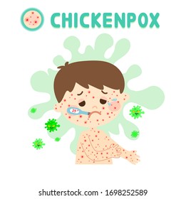 Kids have Chickenpox and Virus Vector    
