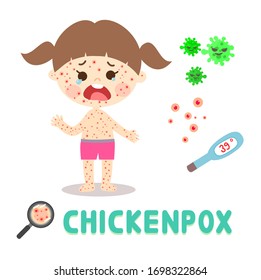 Kids have Chickenpox and Virus Vector    