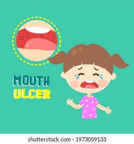 Kids Have A Mouth Ulcer Vector