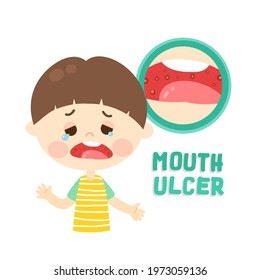 Kids Have A Mouth Ulcer Vector