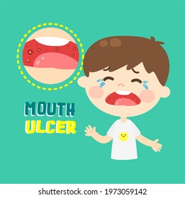 Kids Have A Mouth Ulcer Vector