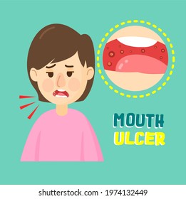 Kids Have A Mouth Ulcer Vector