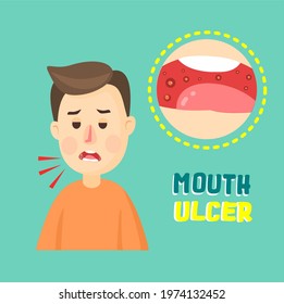 Kids Have A Mouth Ulcer Vector