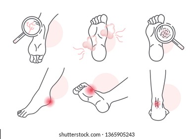 kinds of foot skin care problem set 