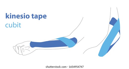 Kinesio tape, kinesiotaping. Vector isolated illustration of hand and cubit with blue kinesio tapes