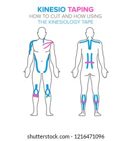 Kinesio taping. How using and how to cut the kinesiology tape for your design