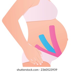 kinesio taping on pregnant woman -vector illustration
