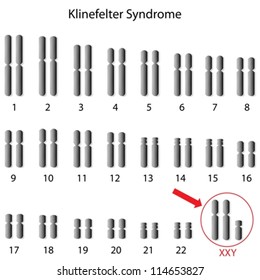 [Jeu] Association d'images - Page 13 Klinefelter-syndrome-260nw-114653827
