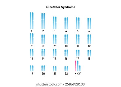 Klinefelter Syndrome Science Design. Vector Illustration.