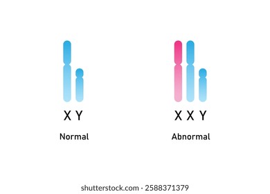 Klinefelter Syndrome Science Design. Vector Illustration.