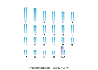 Klinefelter Syndrome Science Design. Vector Illustration.