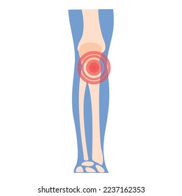 Knie-Arthritis Symbol Karikatur Vektor. Gelenkschmerzen. Arzt