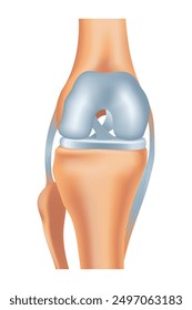 Knee arthrosis. Healthy knee structure. Bone exposure, healthy knee structure comparison. Medical poster with foot bones. Isolated vector illustration
