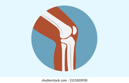 Knee and bone, Osteoarthritis vector illustration