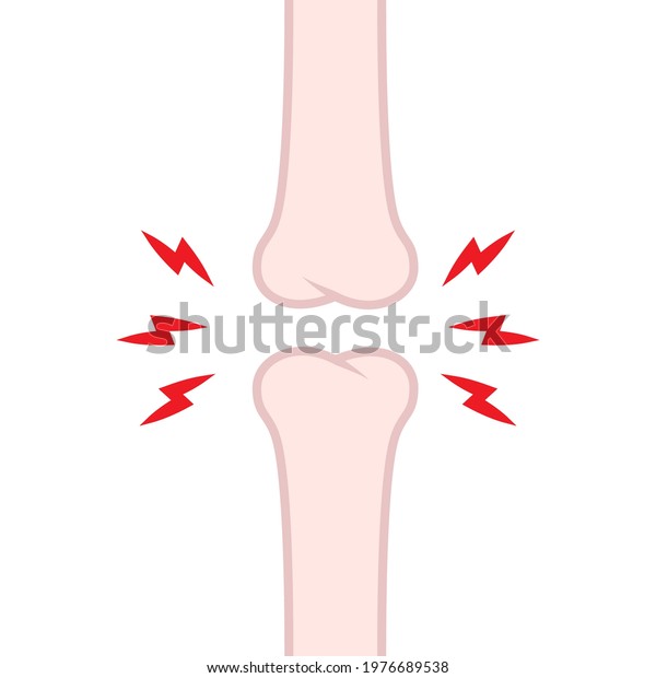 Knee Bone Problems Bone Cartoon Vector Stock Vector (Royalty Free ...