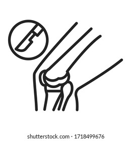Knee disease black line icon. Total knee replacement surgery. Isolated vector element. 