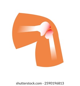 Knee or elbow pain in bones - vector illustration for medicine packaging.