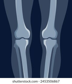 Knee human legs x ray roentgen radiology shot medical healthcare vector flat illustration. Foot feet bones skeleton structure xray image joint limbs diagnostic orthopedic surgery check treatment