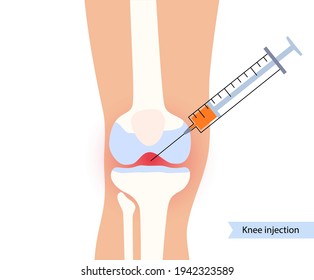 Knee injection concept. DIsease of osteoporosis arthritis, pain inflammation and joint problems in the legs. PRP treatment logo. Medical poster flat vector illustration. X-ray picture in the clinic.