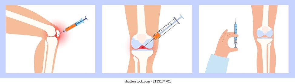 Knee injection concept. DIsease of osteoporosis arthritis, pain inflammation and joint problems in the legs. PRP treatment logo. Medical poster flat vector illustration. X-ray picture in the clinic.