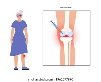 Knee injection concept. Old age woman in clinic. DIsease of osteoporosis arthritis, pain inflammation and joint problems in the legs. PRP treatment vector illustration. Mature senior lady in hospital