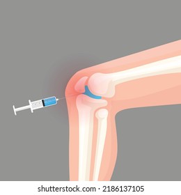 Knee injection inflamation redness vector illustration