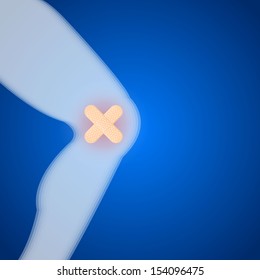 Knee injuries on the blue background. Illustration.