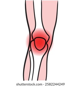 Knee injury inflamation redness. Arthritis Joint. vector illustration
