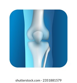 Knee joint 3D square icon - synovial joint of legs bones flexion, Vector illustration
