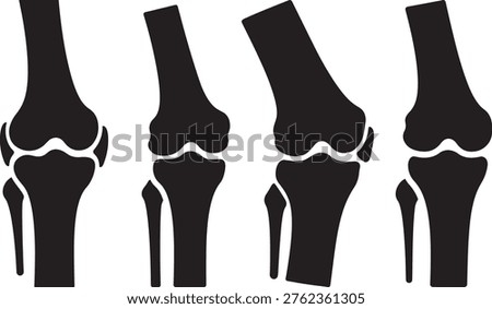 Knee joint anatomy, leg bones, medical study, human leg structure