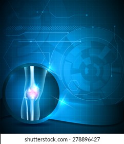 Knee joint blue background, joint treatment technology