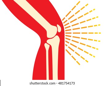 Knee Joint Bones - Pain Icon (orthopedic Clinics Design)