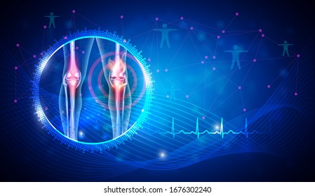 Knee joint damage and treatment concept on an abstract blue background