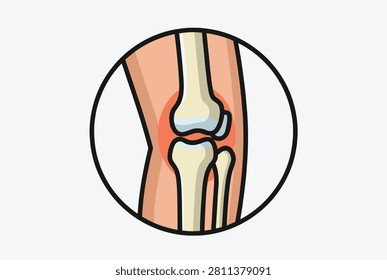 Knee joint illustration features a red glow to indicate inflammation, pain, or injury within the skeletal structure for medical use.