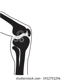 Knee Joint illustration in white black. Orthopedic medical concept.