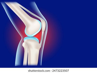 Knee joint inflammation. Realistic human knee on blue background. Concept vector illustration