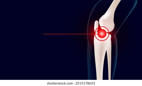 Knee joint and leg bones pain throbbing bones on blue background. 3D vector illustration editable